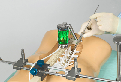 Endoscopic Spine Surgery in Anna Nagar