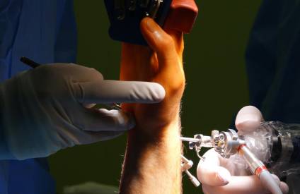 Orthopaedic Doctor in Chennai