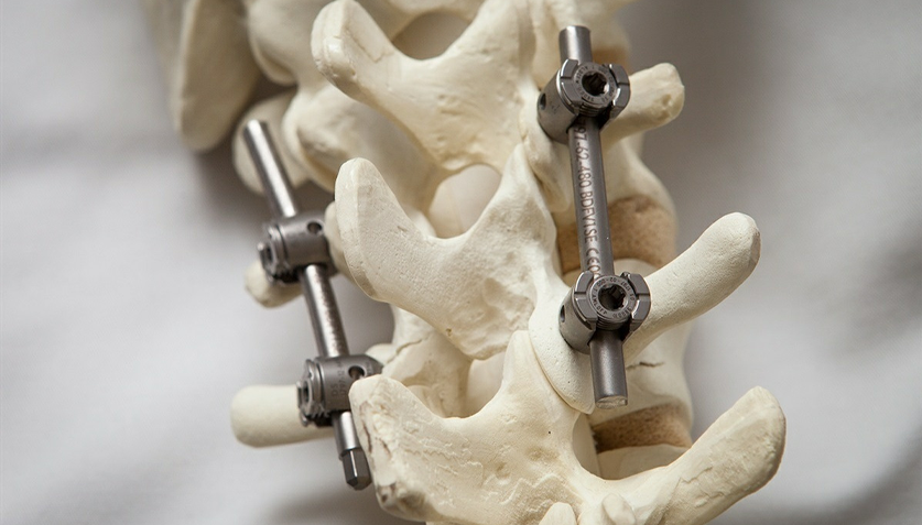 Spine Fracture Surgery in Anna Nagar