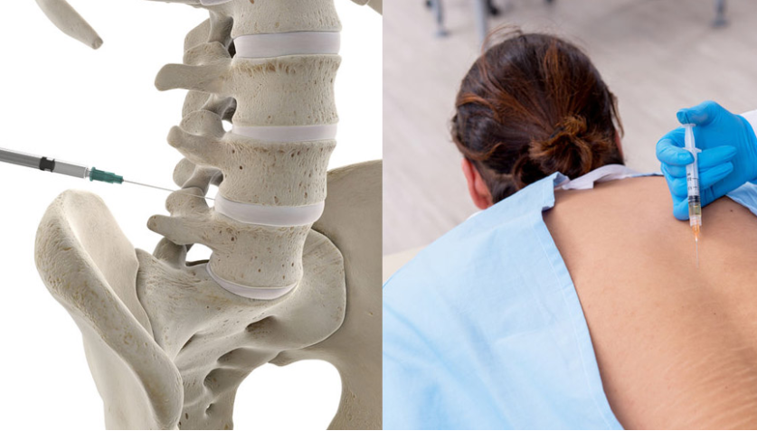 Spine Injections in Anna Nagar
