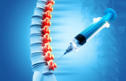 Spinal Injections for Back Pain in Anna Nagar